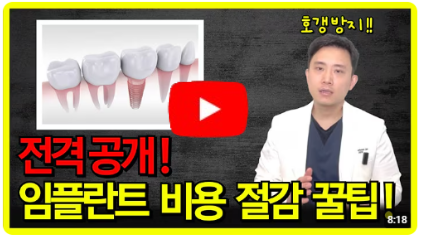 임플란트 비용, 가격 비교로 최저가 찾는 꿀팁 공개합니다!
