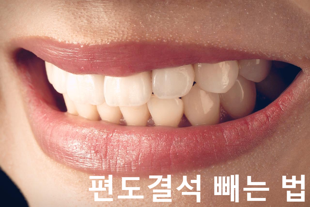 편도결석 빼는 법과 예방법 간단 정리(입 냄새의 주범!)