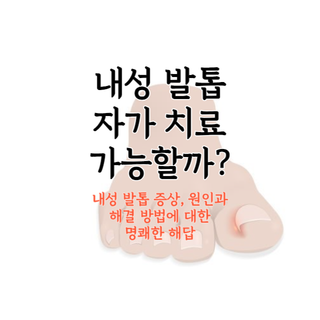 내성-발톱-자가-치료