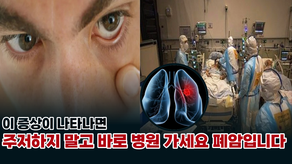  '이증상이 있으면 즉시 병원 가세요' 우리 몸에서 보내는 폐암의 신호