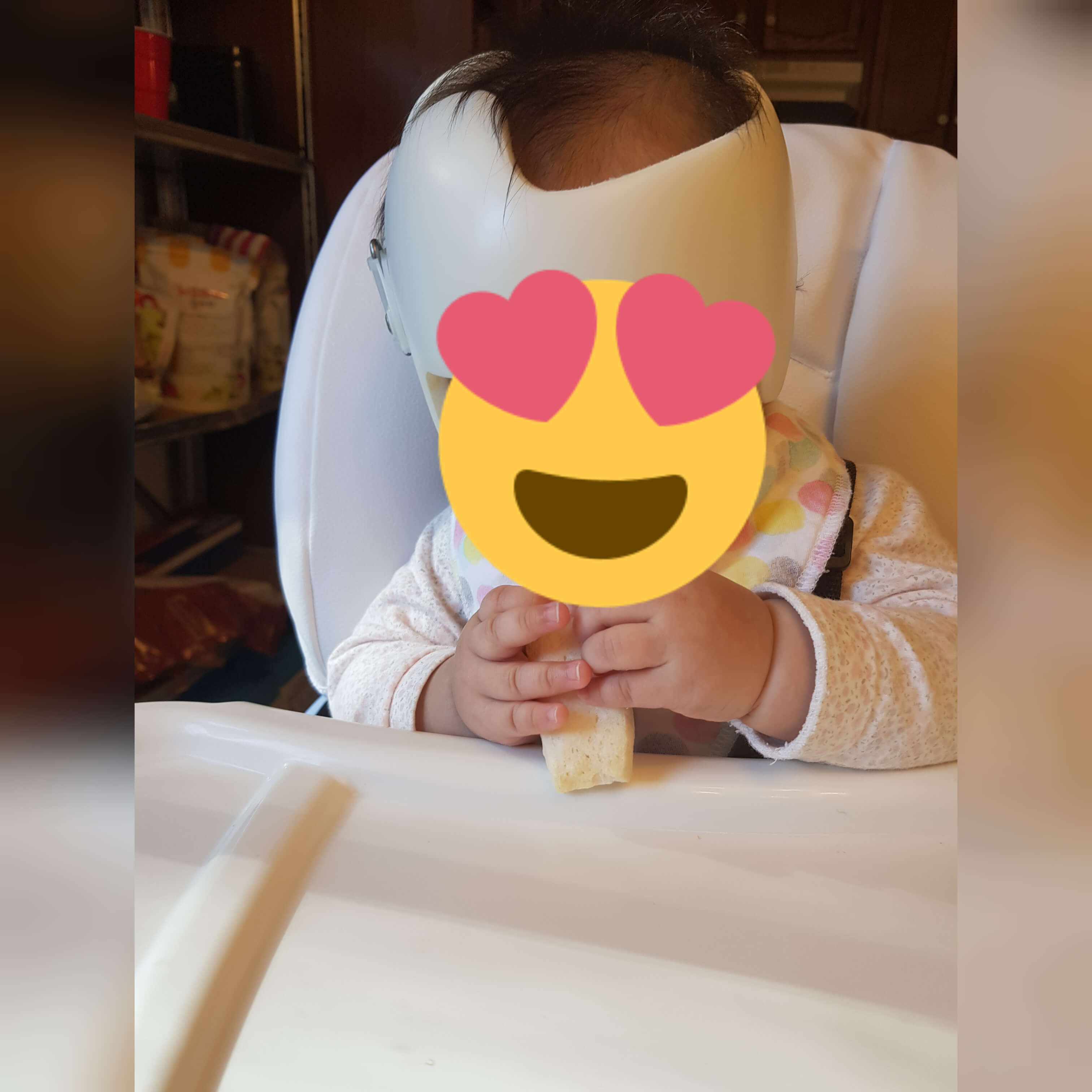  미국에서 아기 사두/단두 헬멧 두상 교정 진행 시작 과정과 방법