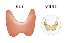 갑상선 기능 저하증 증상