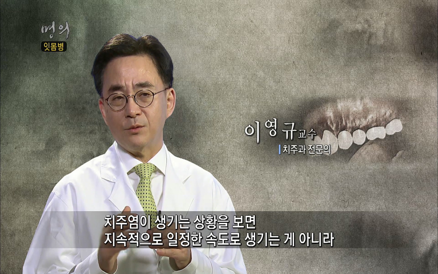 EBS 명의 헬스케어 - TV - 교육의 중심 EBS2015년 1월 16일 (금) 밤 9시 50분, EBS1.mp4_20220505_145227.785.jpg