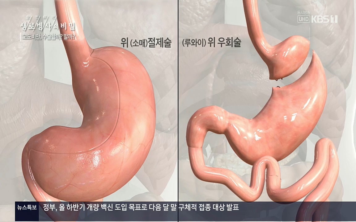 생로병사의 비밀.E828.220728p.H264-F1RST.mp4_20220728_204809.743.jpg