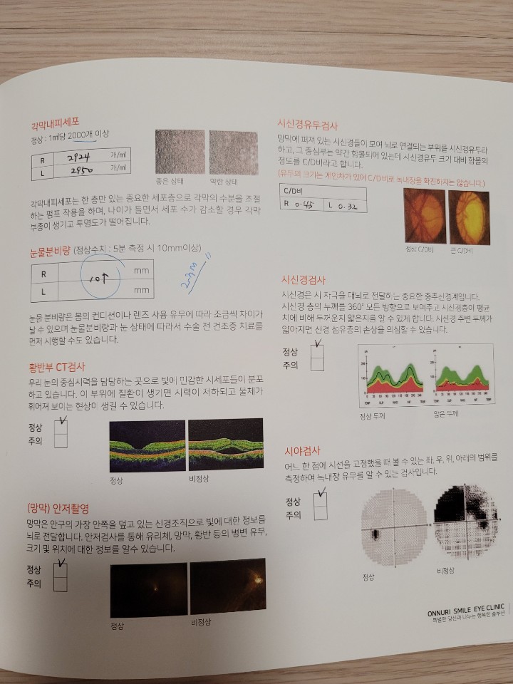 라식수술 후기/내돈내산/나안과/천안라식/노안/천안안과/40대 라식/1일차/2일차/3일차 8
