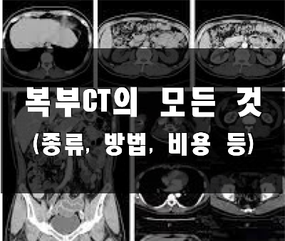  복부CT의 종류, 방법, 부작용, 그리고 비용에 대해 알아보자
