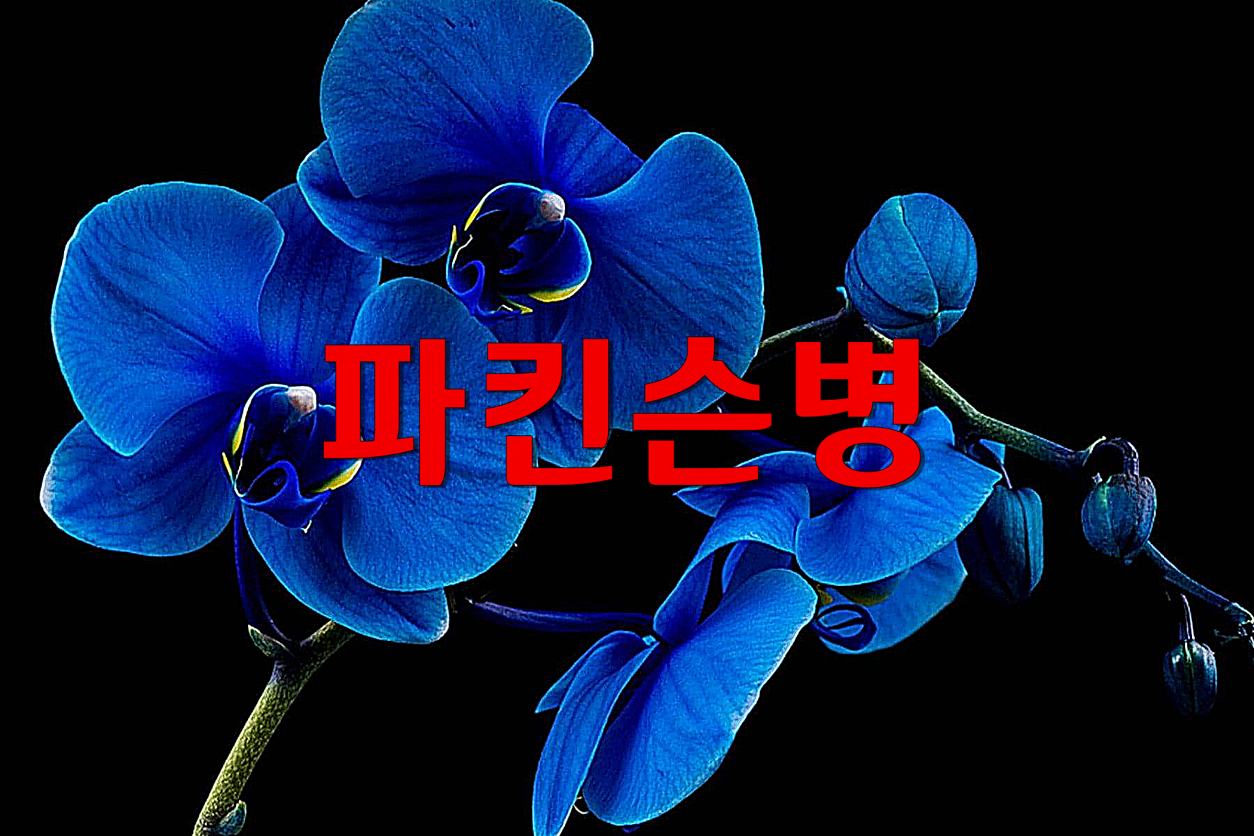  파킨슨병, 파킨슨증후군, 루게릭병, 질환별 특징 핵심 요약