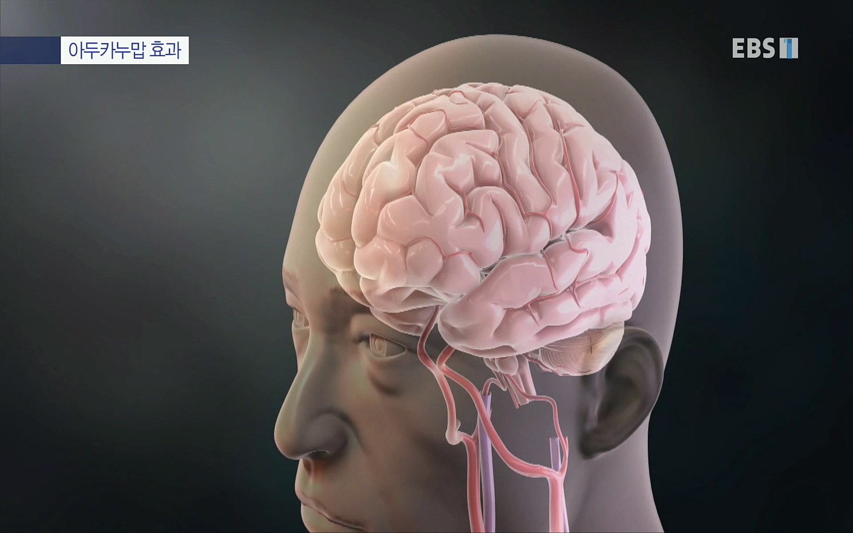 EBS 명의 헬스케어 - TV - 교육의 중심 EBS명의 15년 치매 치료의 패러다임이 바뀐다.mp4_20220808_211019.636.jpg