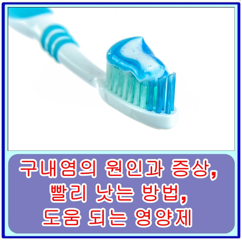  구내염의 원인과 증상, 빨리 낫는 방법, 도움 되는 영양제