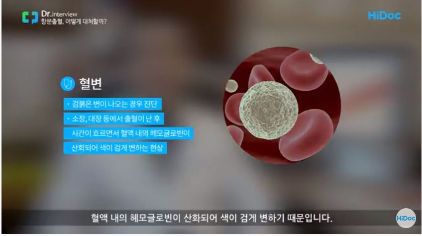  치질 대장암 혈변차이,대장암 초기증상은?