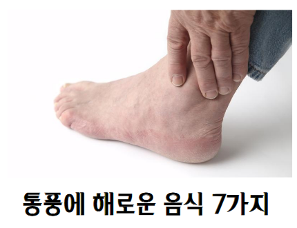 통풍에 해로운 음식 7가지