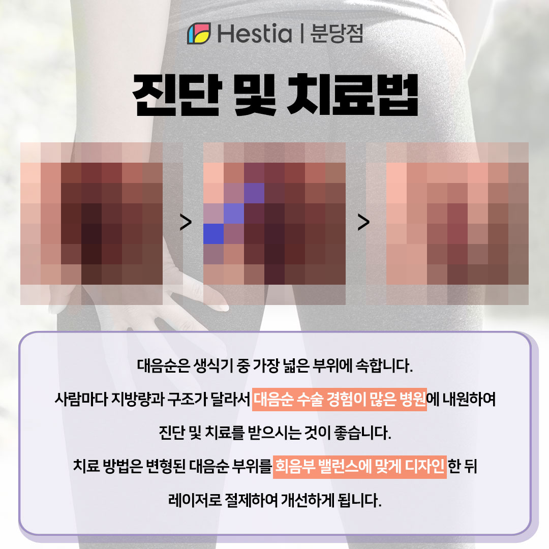 외음부염 연고 대음순 염증 수지구청역산부인과 진단 및 치료 방법은?