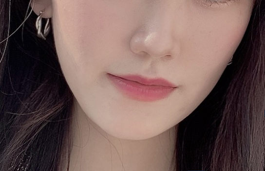 2차 코 봉오리 축소 코 조각 주사 후기교대역피부과 1개월 반 지났어 2