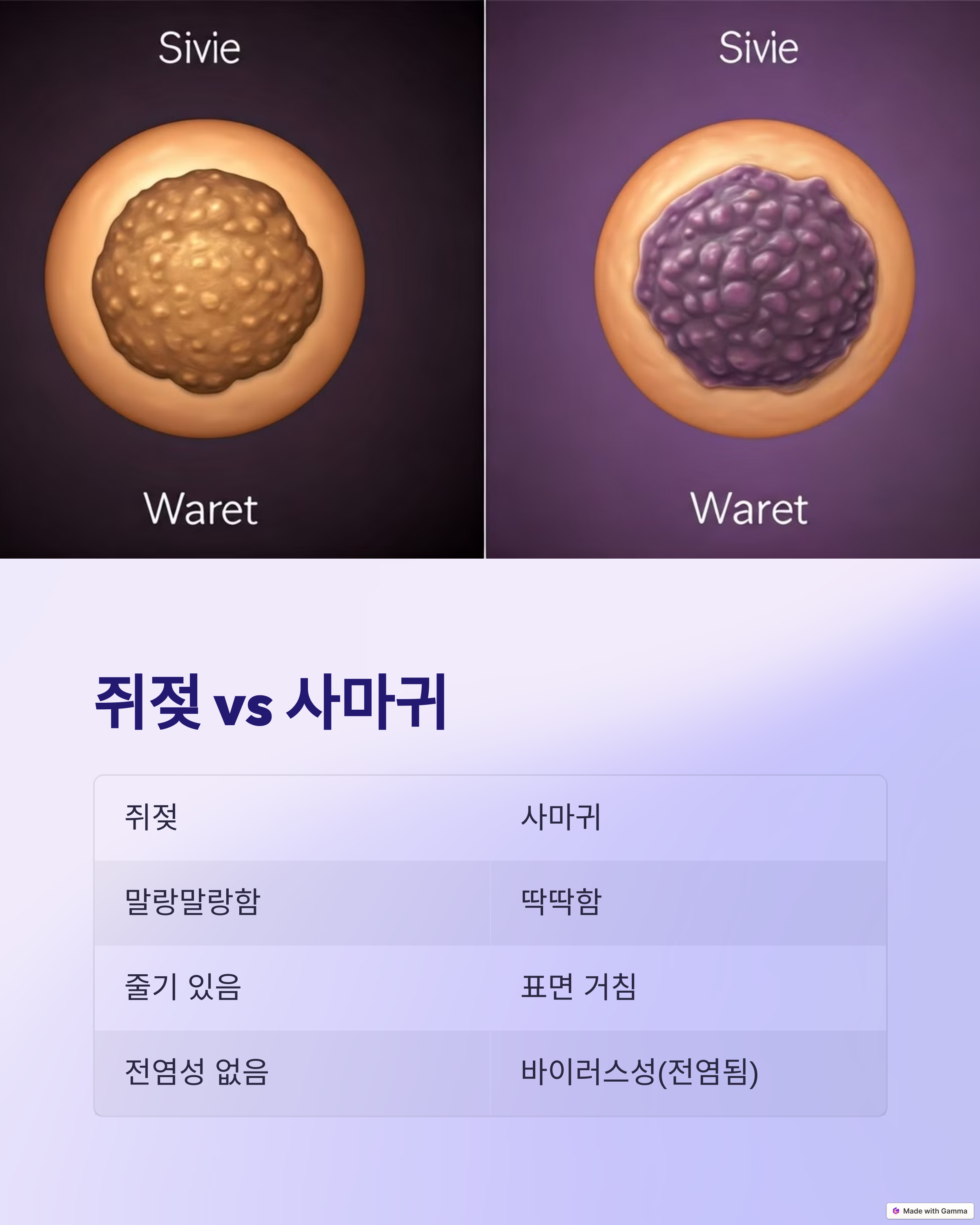 쥐젖없애는방법 쥐젖제거 쥐젖수술 쥐젖치료
