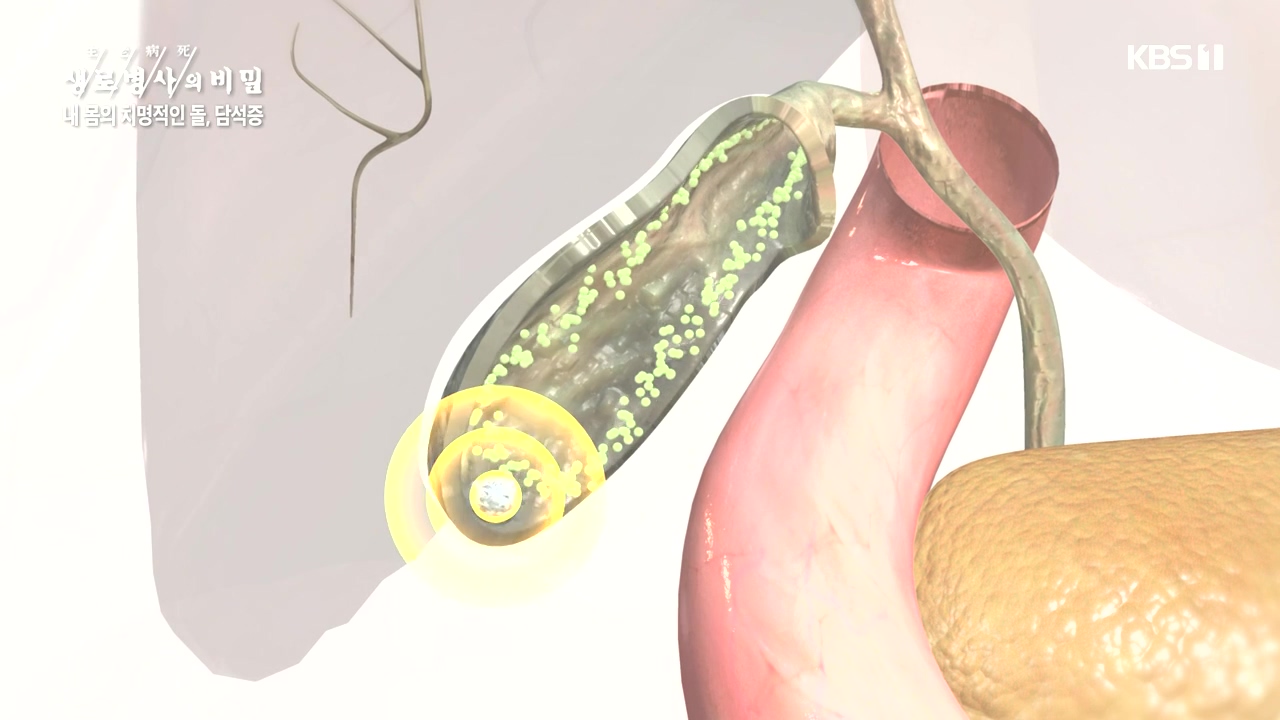 생로병사의 비밀.E886.231019p-NEXT.mp4_20231019_201727.188.jpg