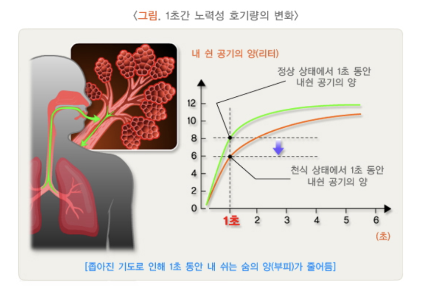 1초간 노력성 호기량