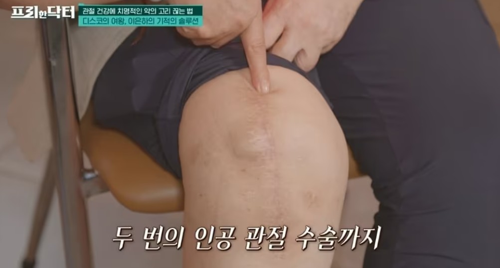 이은하