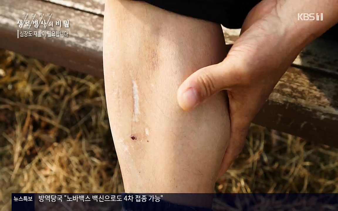 생로병사의 비밀.E820.220428p-NEXT.mp4_20220501_192732.040.jpg