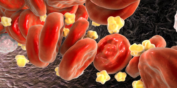 높은 중성 지방의 증상 요약 18