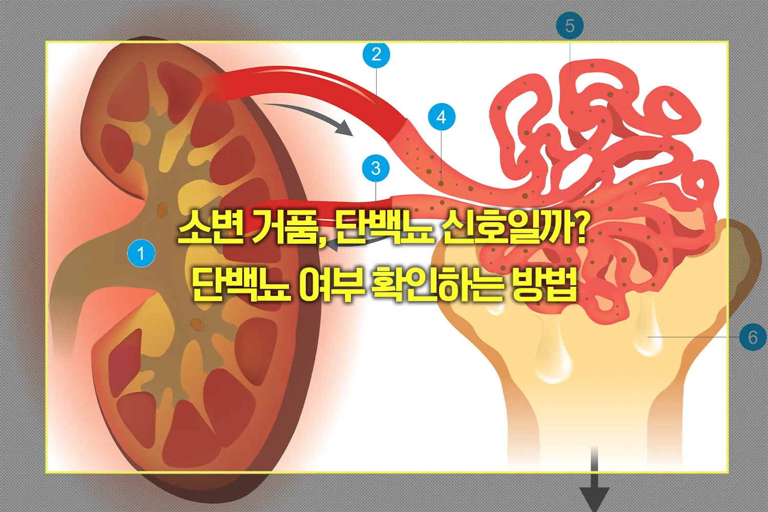 소변 거품 단백뇨 여부 확인하는 방법
