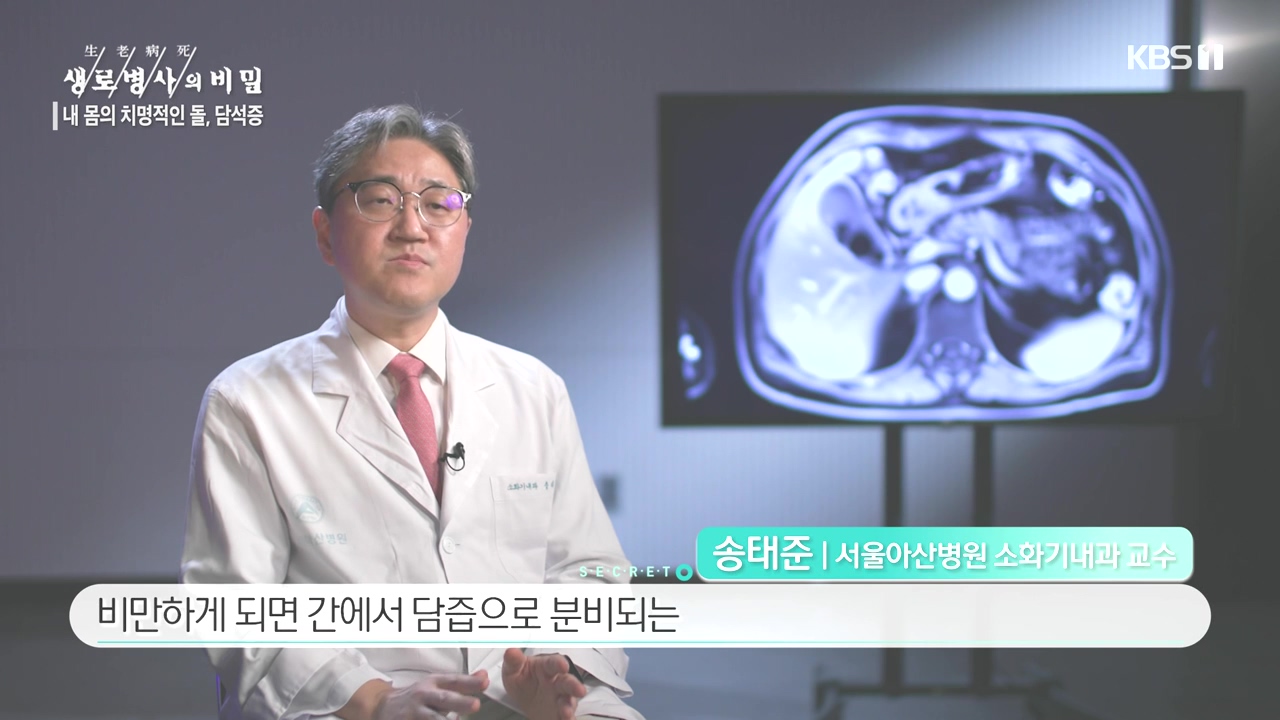 생로병사의 비밀.E886.231019p-NEXT.mp4_20231019_201745.846.jpg