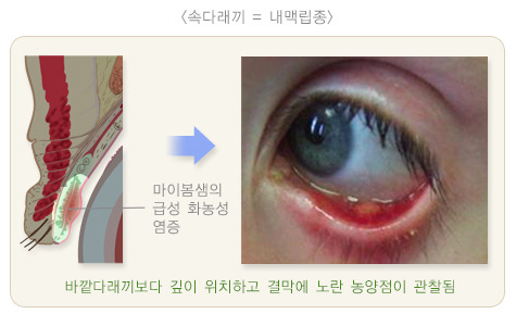 자연치유 이미지
