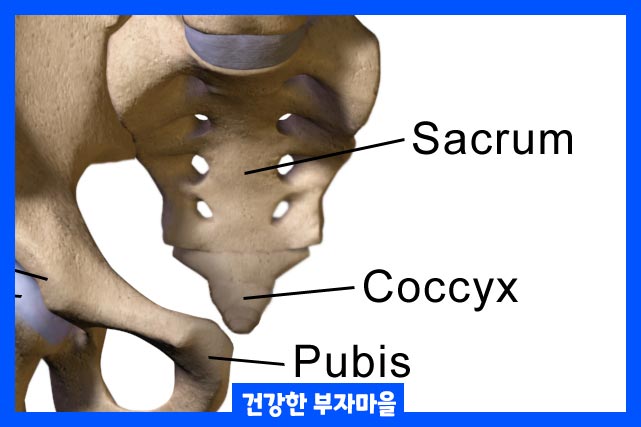 척추와 엉덩이에 영향을 미치는 진행성 유형의 염증성 관절염