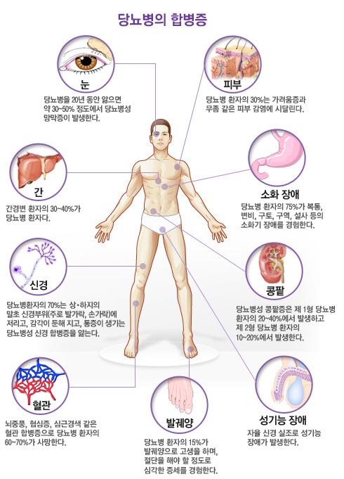  나의 당뇨 예방 이야기
