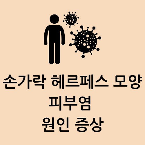 손가락 헤르페스 모양 피부염 원인 증상