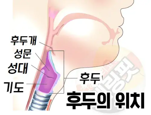 역류성-후두염이-생기는-위치