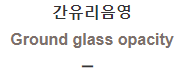  간유리음영 [Ground glass opacity]