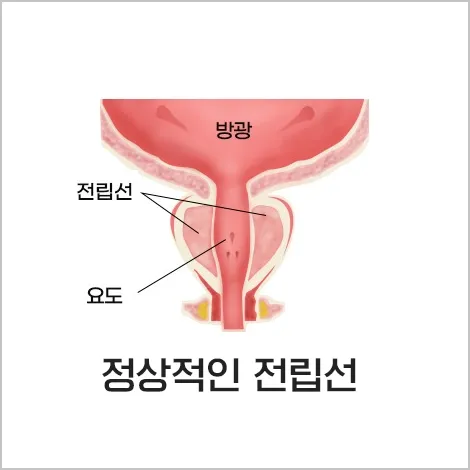 정상적인 전립선