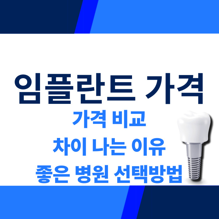 임플란트 가격 비교