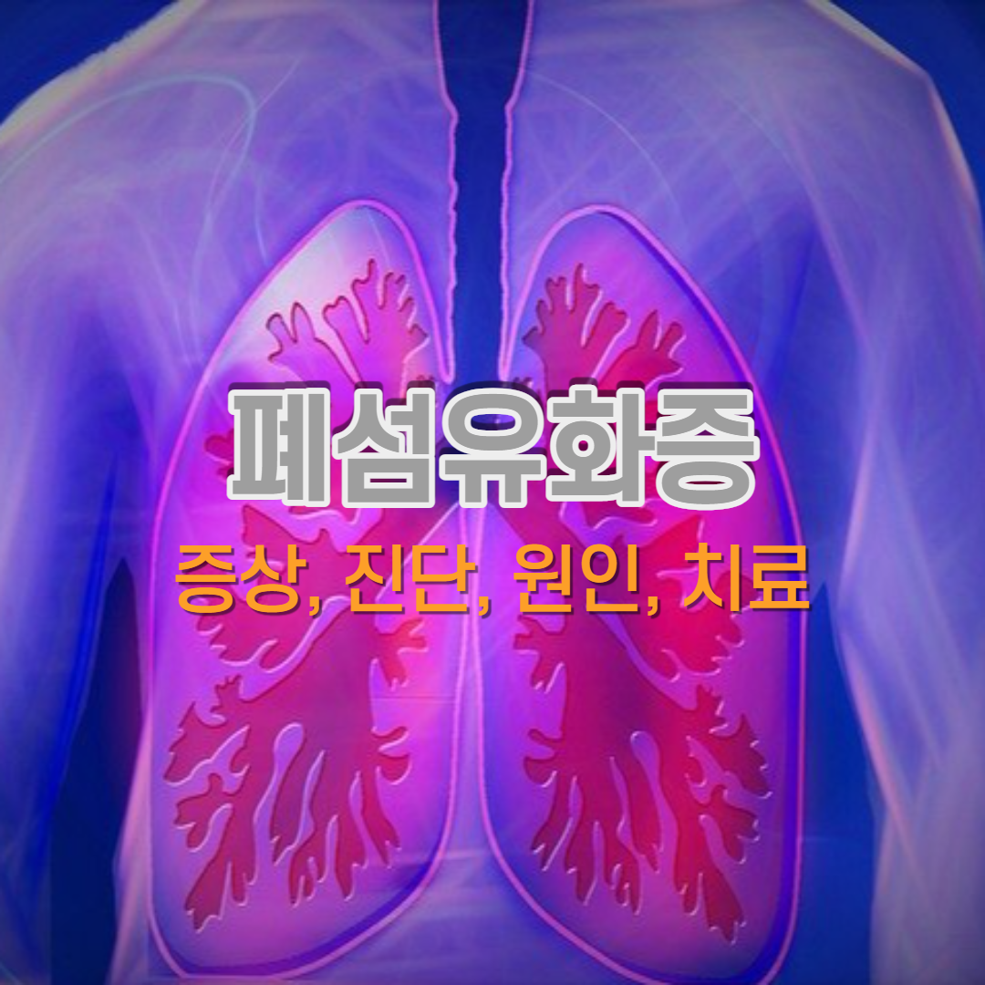  폐섬유화증 증상, 진단, 원인, 치료