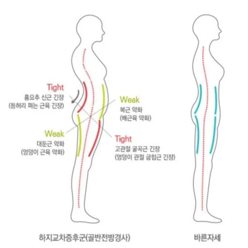  코어근육이 무너진 사람 특징