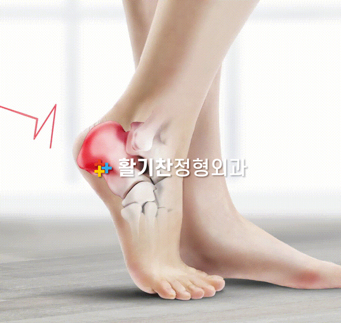  갈현동정형외과, 특별한 이유없이 발목이 아프다고 하는 아이들