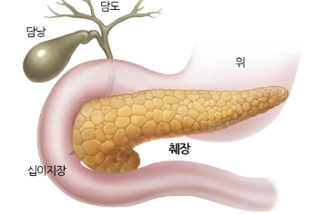 췌장암 초기증상 7가지