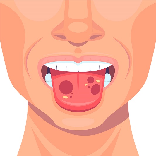 pain-in-the-mouth