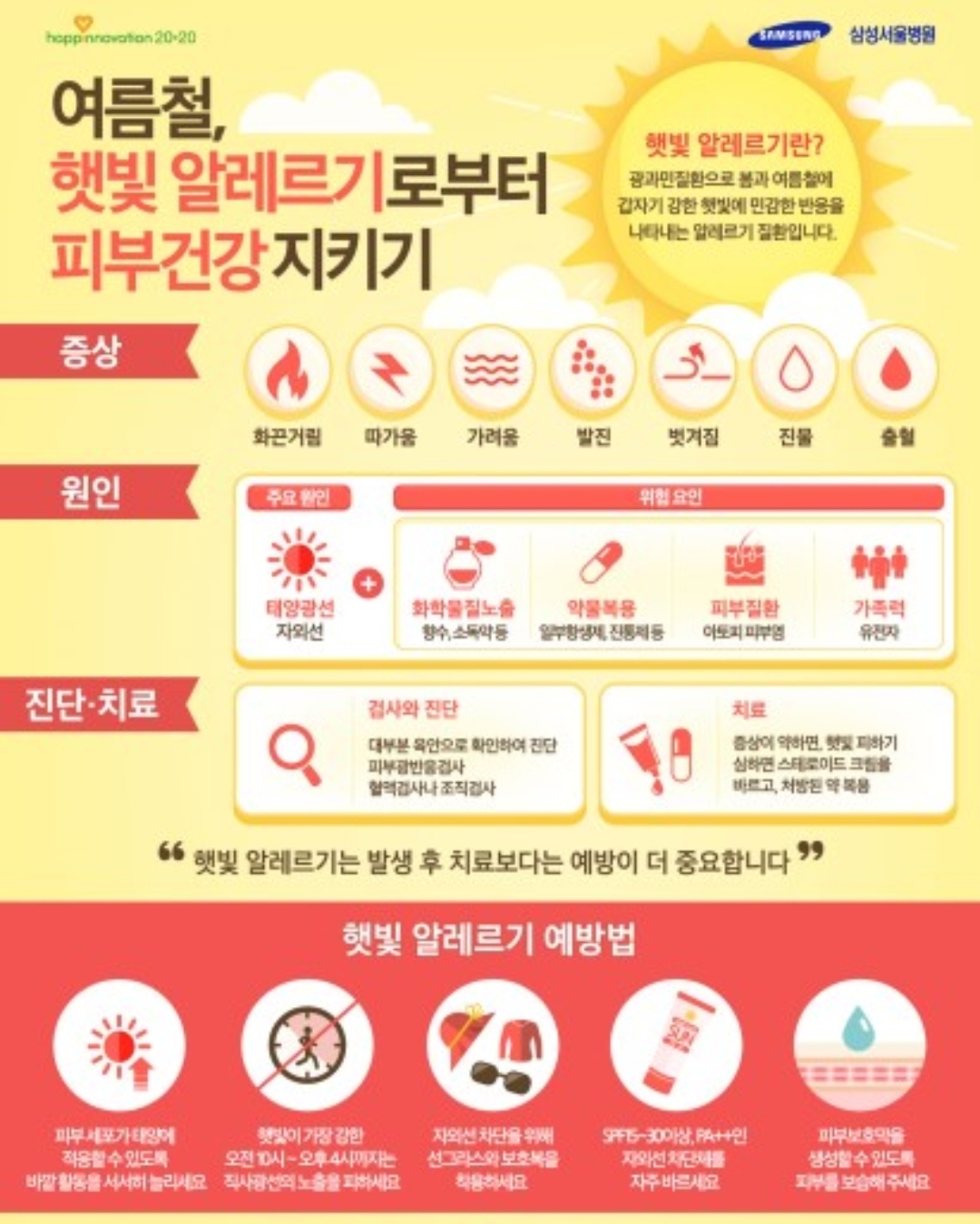  햇빛 알레르기 연고는? 피부 햇빛 알레르기 증상
