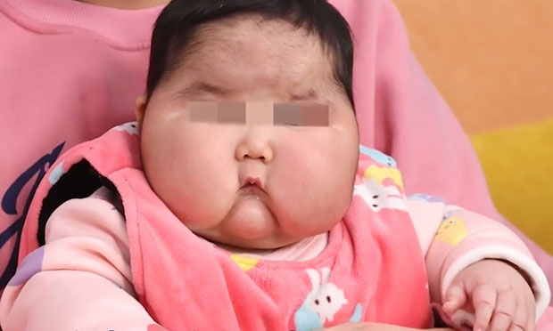  중국 호르몬크림 부작용 논란
