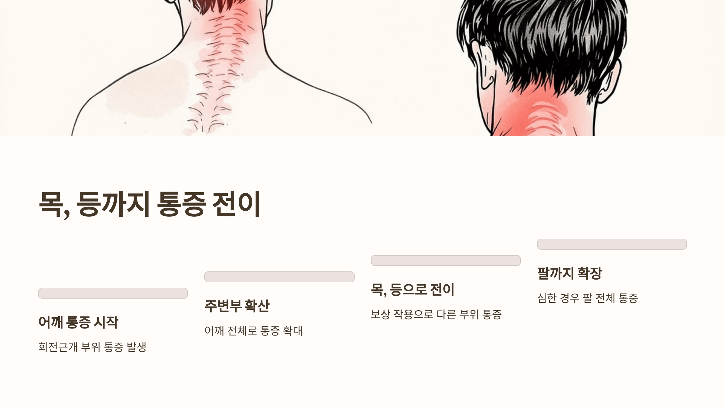 어깨 회전근개파열 사진입니다.