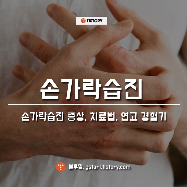 손가락 습진, 연고에만 의존하고 4