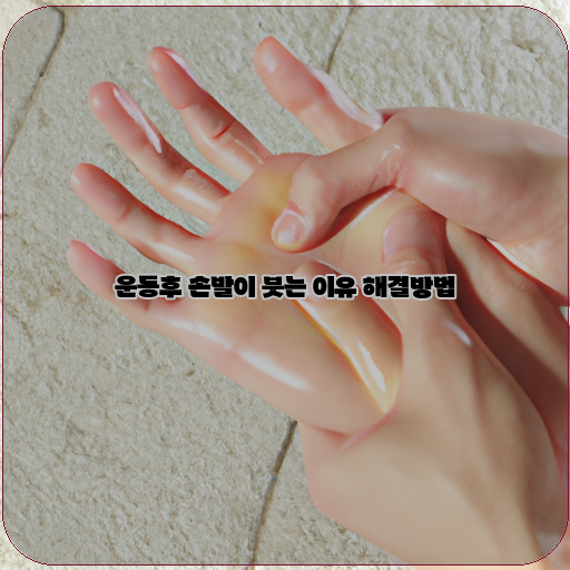  운동 후 손발 붓음! 이유와 해결방법 알아보기