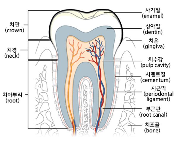 풍치-치주염-원인