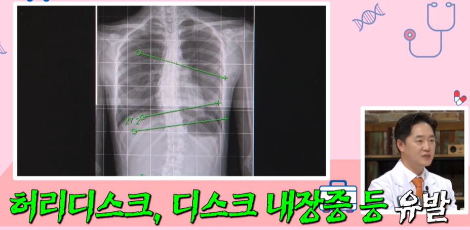 프로테오글리칸 효능