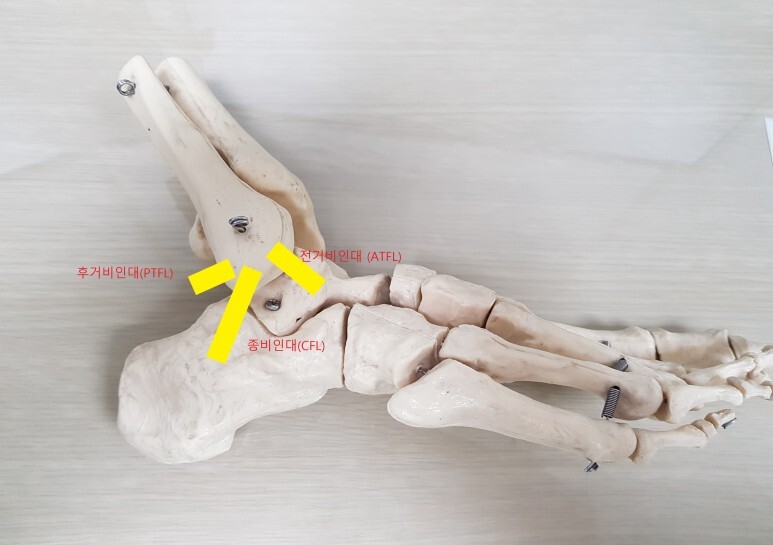  발 삐끗했다? 생활형 족부 질환의 치료법