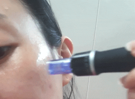 pdrn MTS홈케어에 찰떡인 브나인 15
