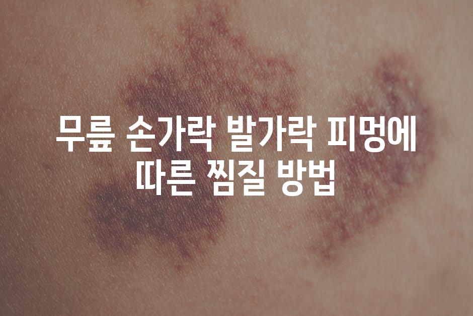 무릎 손가락 발가락 피멍에 따른 찜질 방법