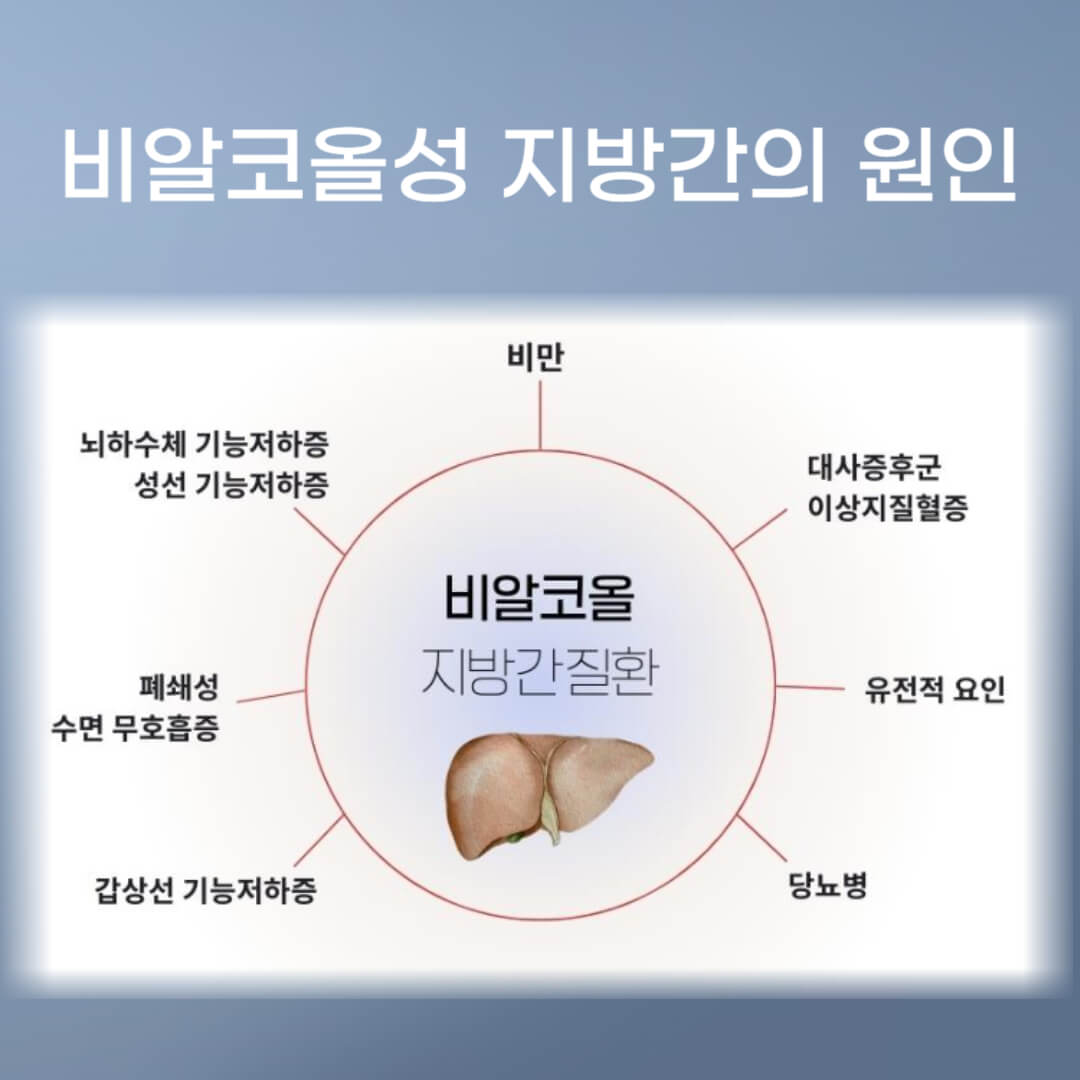 비알코올성 간질환 원인