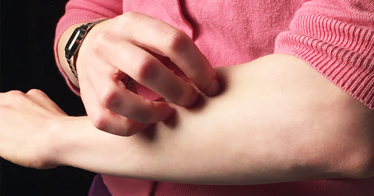  온 몸이 가려우면 혹시 이 병? If You Notice This on Your Skin, Get Your Kidneys Checked, Experts Warn